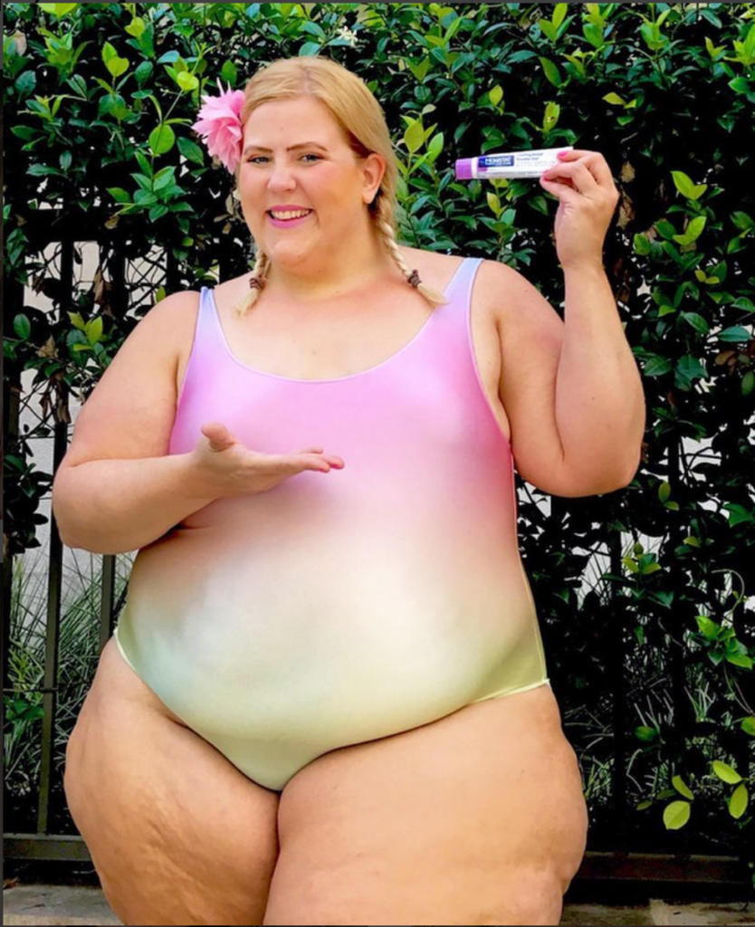 How I Prevent Chub Rub + Summertime Chafing - Glitter + Lazers